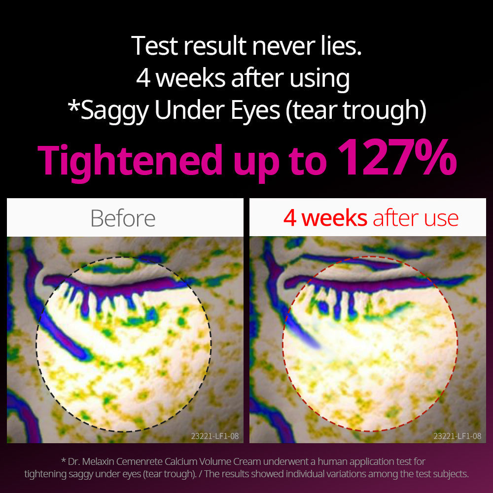 Calcium Collagen Calcium Eye Care Line