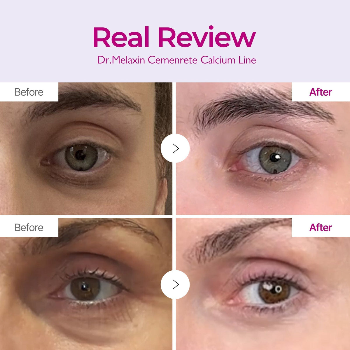 Calcium Intense Cream