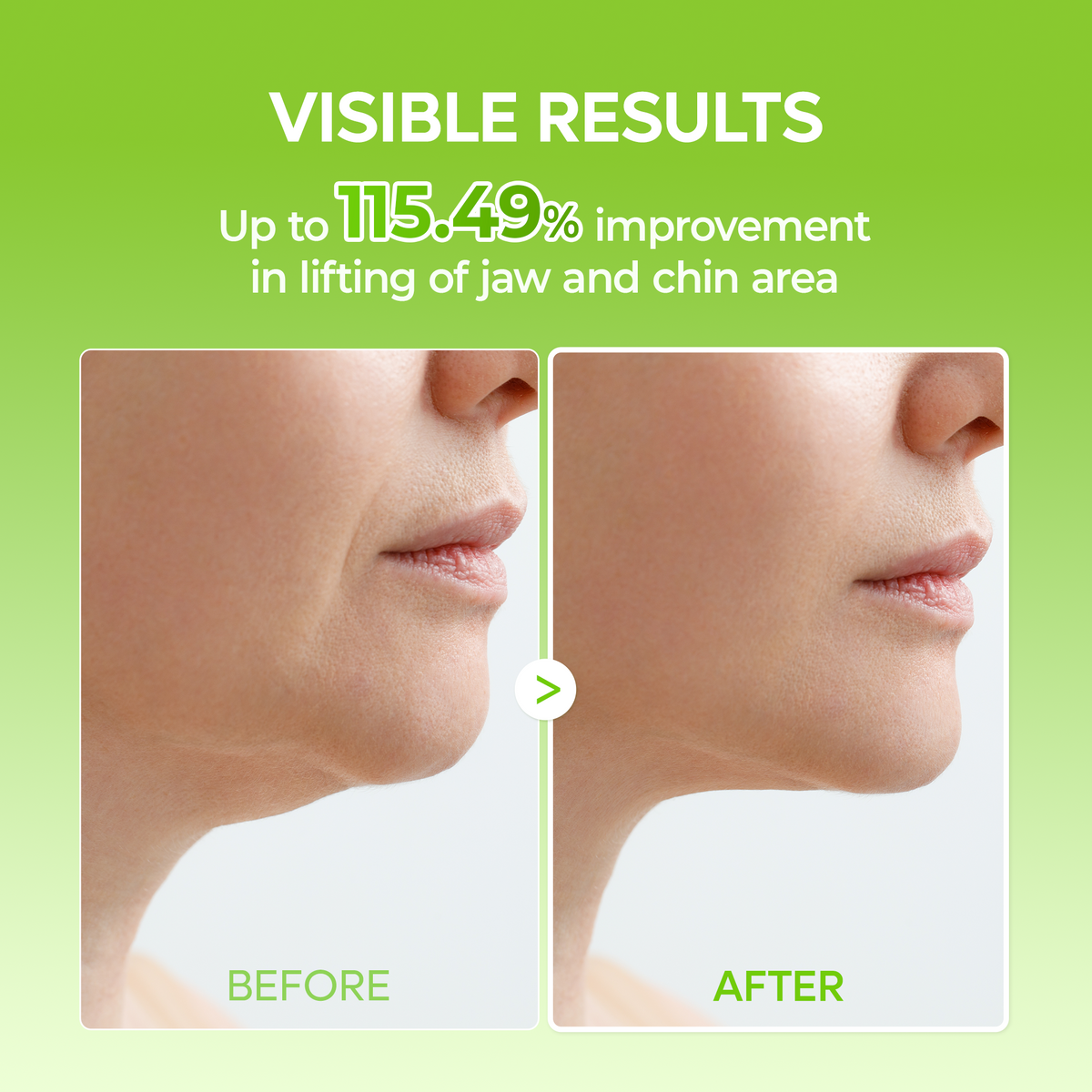 [CLEARANCE SALE] 3-Step CACTOX Pore Tightening Set